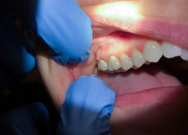 Best Urgent Care for Lost Fillings or Crowns in Golden Hills, CA